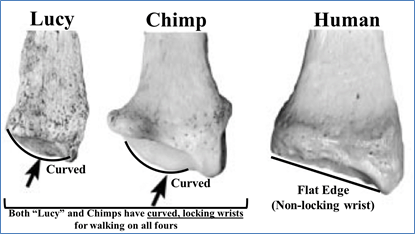 Figure-23.-Lucys-Locking-Wrist